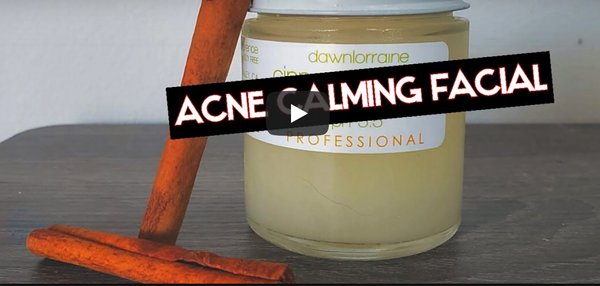 Acne Calming Facial feat. Cinnamon Detox Clarifying Peel with Vanity Beauty, LLC